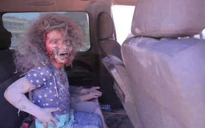 حقيقة صورة طفلة جريحة في حادث المنيا