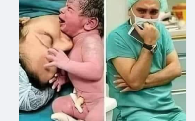 حقيقة صور وفاة أم بعد الولادة وطبيبها يبكي تأثراً