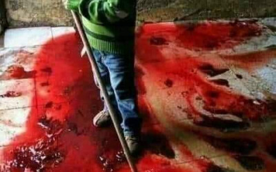 حقيقة صورة الطفل الفلسطيني الذي يمسح دماء عائلته