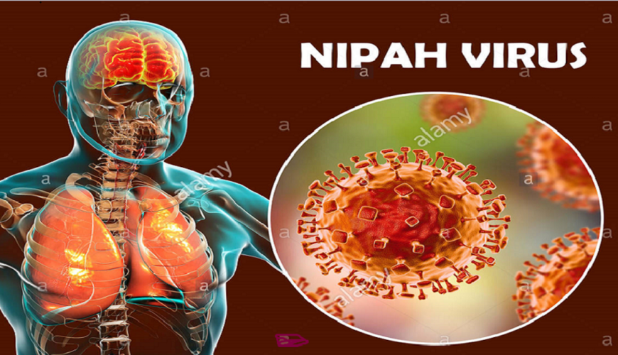 حقيقة عدم ظهور فيروس نيباه منذ التسعينات
