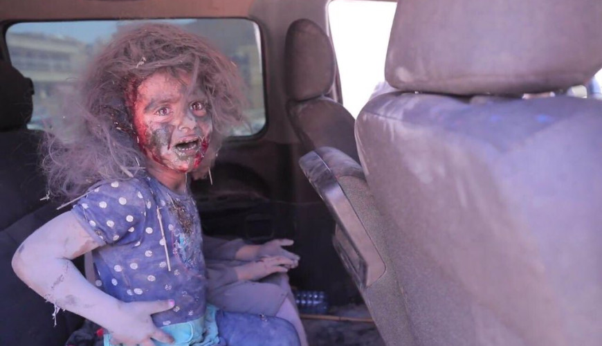 حقيقة صورة طفلة جريحة في حادث المنيا