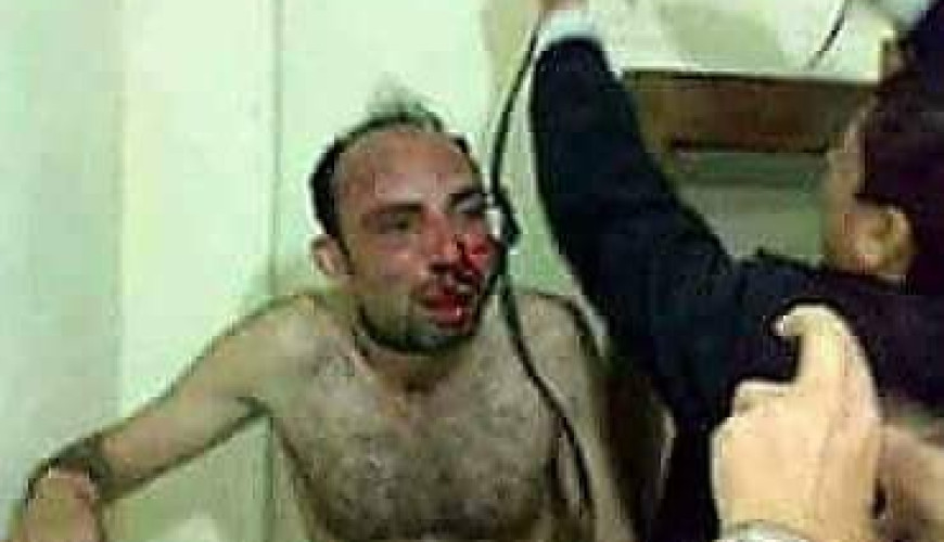 حقيقة صورة معتقل يتم شنقه في مصر