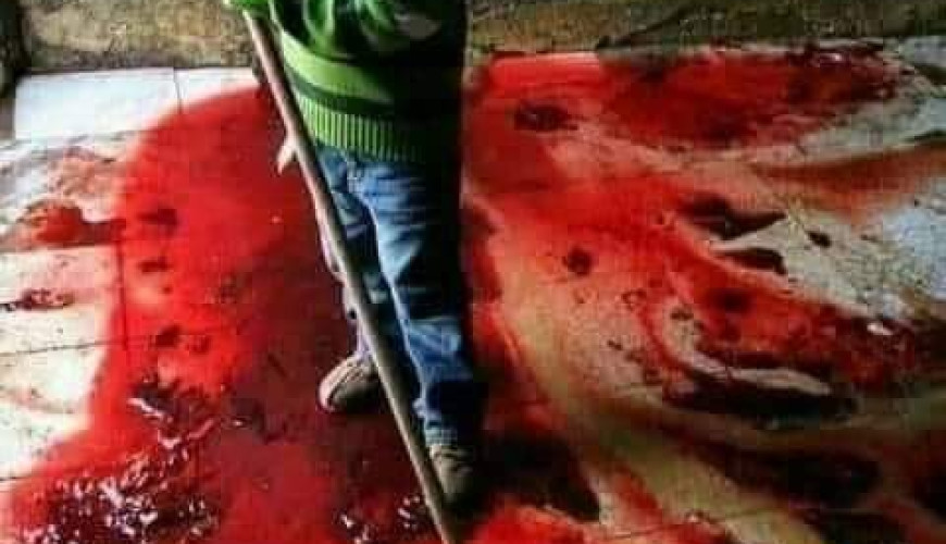 حقيقة صورة الطفل الفلسطيني الذي يمسح دماء عائلته